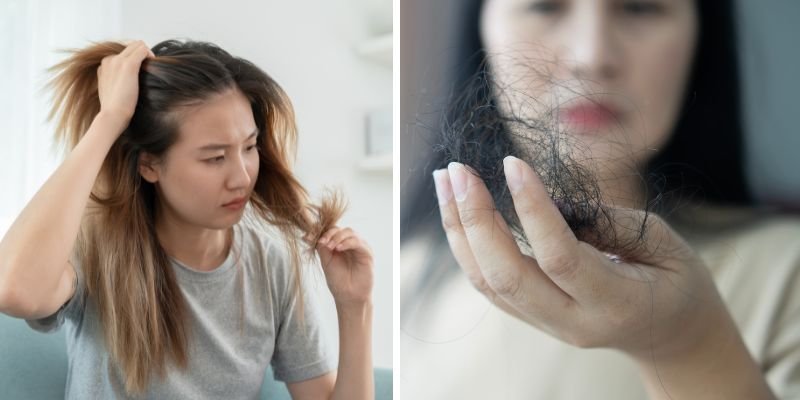 Home Remedies Vs. Hair Loss Treatment: A Comparison Guide