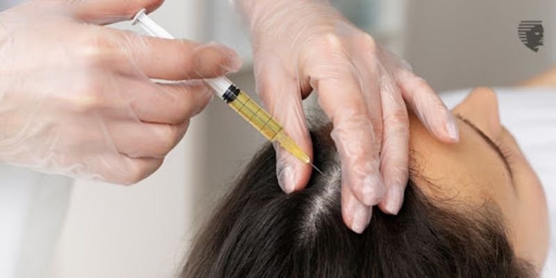 Choosing a Hair Clinic