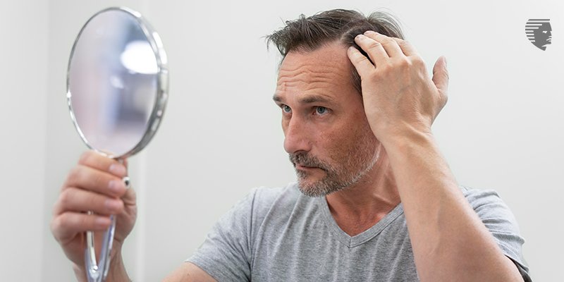 Treatment Options for Autoimmune-Related Hair Loss