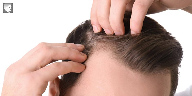 چه زمانی باید با یک پزشک متخصص مو تماس گرفت
