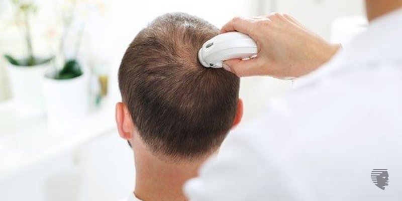 How Much Does Laser Hair Treatment Cost in India?