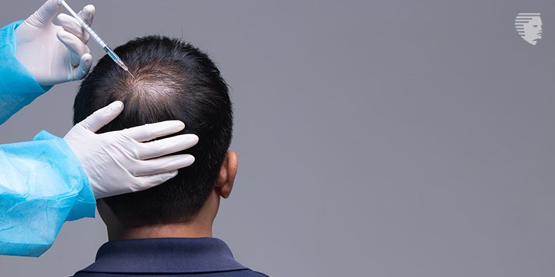 چه چیزی باعث ریزش موی من می‌شود؟
