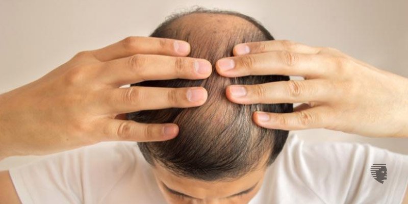 چگونه می‌توانم ریزش موی فوری خود را متوقف کنم؟