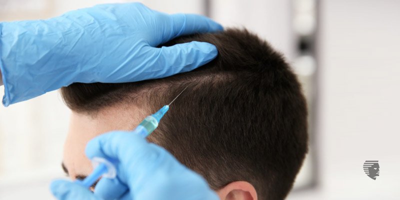 How can you slow down Hair Fall in Men?