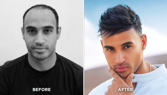 محمد قبل